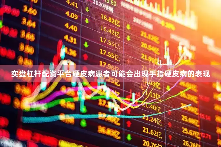 实盘杠杆配资平台硬皮病患者可能会出现手指硬皮病的表现